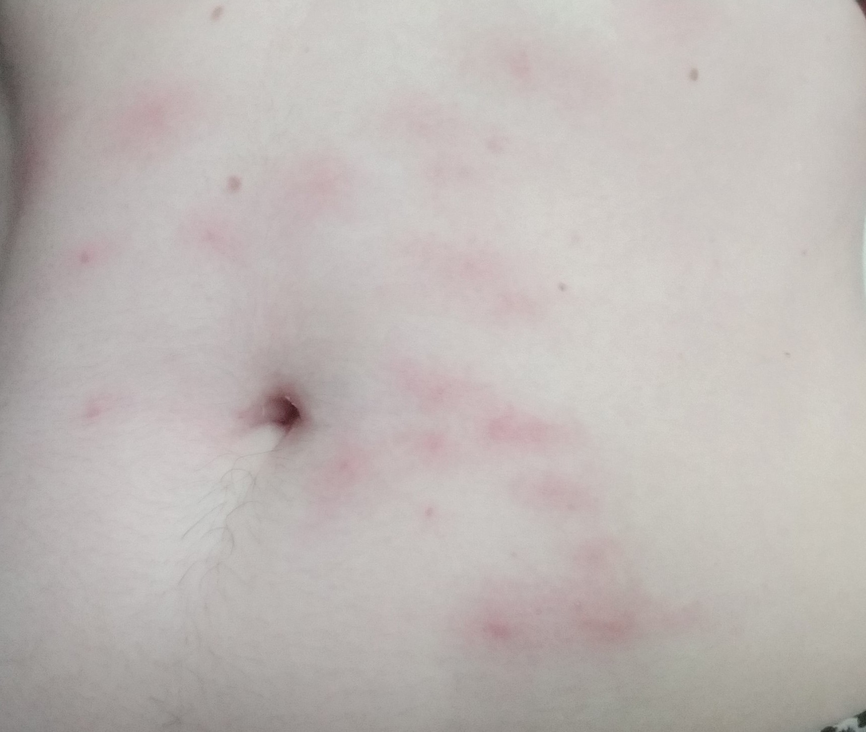 What is this game? - My, Stains, Doctors need help, , Dermatology, Rash