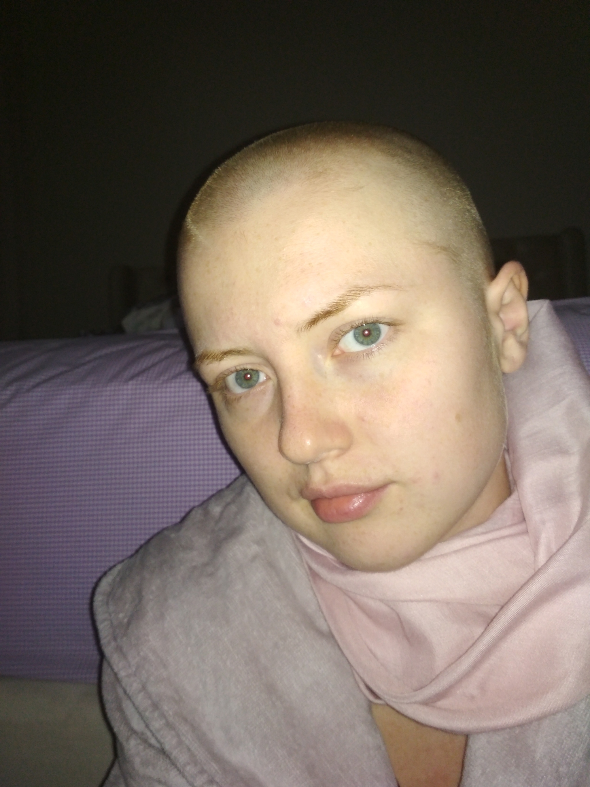 Hodgkin's lymphoma or Turkish holidays. Part 4 - My, Crayfish, Oncology, Lymphoma, Hodgkin's lymphoma, Hair, Longpost