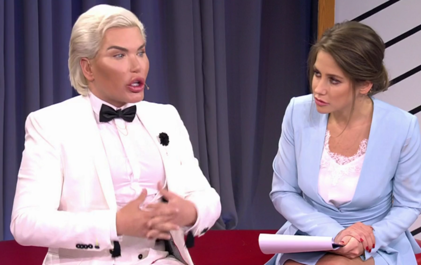 How to turn into a living Ken? Operation history of Rodrigo Alves. - My, Cosmetology, Plastic surgery, Face, The medicine, Fashion, beauty, Psychology, Longpost