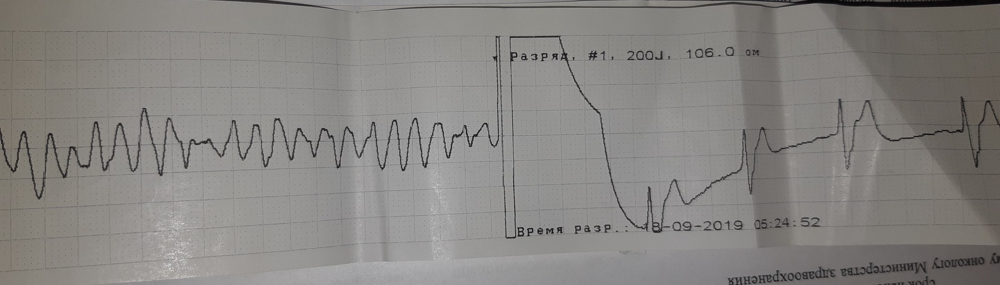 Days of cardio... - My, Weekdays, Doctors, A life, Republic of Belarus, The rescue, 2019, Longpost